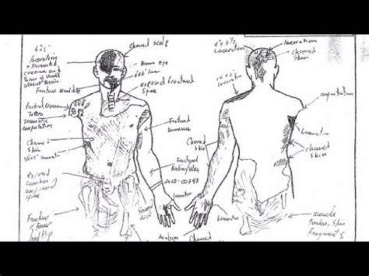 Kobe Bryant Autopsy Report Drawing: Kobe And Gigi's Horrific Death
